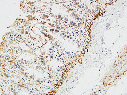 a00649 1 ptx3 primary antibodies ihc testing 7