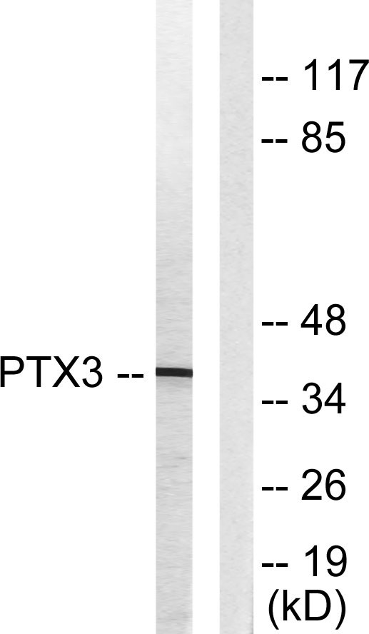 Western blot analysis of lysates from 293 cells, using PTX3 Antibody