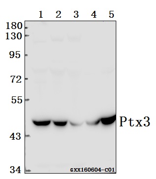 Western blot (WB) analysis of Ptx3 (Y27) polyclonal antibody at 1:500 dilution
Lane1:SGC7901 whole cell lysate(40ug)
Lane2:786-O whole cell lysate(40ug)
Lane3:HEK293T whole cell lysate(40ug)
Lane4:The Brain tissue lysate of Rat(40ug)
Lane5:The Brain tissue lysate of Mouse(40ug)
