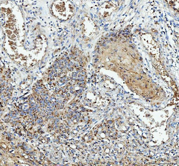 a00651 2 il1ra primary antibodies ihc testing 2