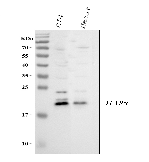 a00651 2 il1ra primary antibodies wb testing 1
