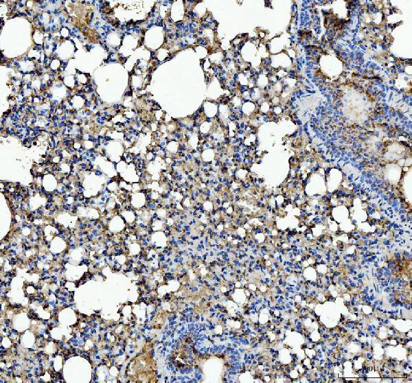 a00651 5 il1rn primary antibodies ihc testing 4