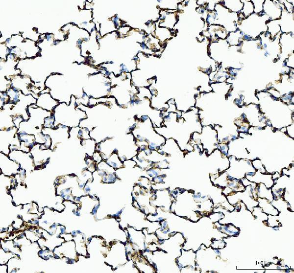 a00651 5 il1rn primary antibodies ihc testing 5