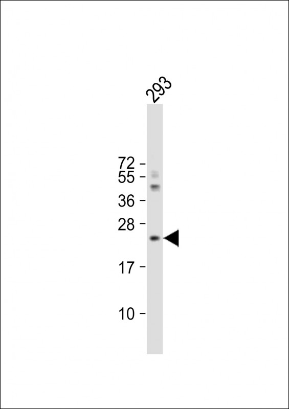 a00651 anti il1rn antibody c term wb testing 2
