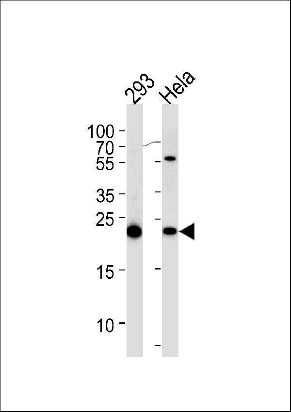a00651 anti il1rn antibody c term wb testing 3