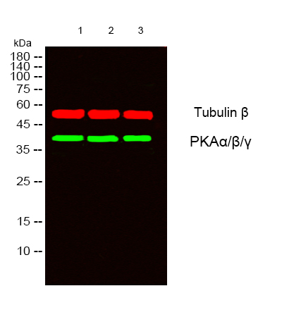 Immunohistochemistry analysis of paraffin-embedded human colon carcinoma tissue, using PKA alpha/beta CAT Antibody