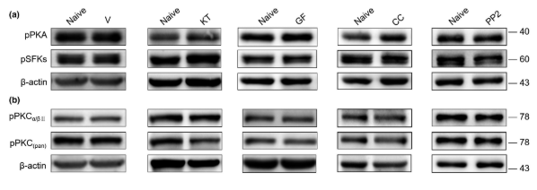 Western blot analysis of lysates from 1) 22RV1, 2) Hela , 3) COLO205 cells, (Green） primary antibody was diluted at 1:1000, 4°over night, secondary antibody was diluted at 1:10000, 37° 1hour