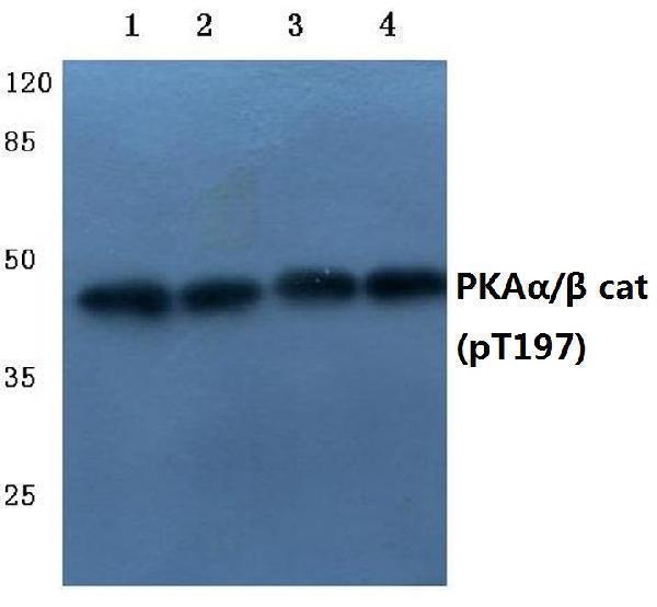Western blot (WB) analysis of P-PKAα/β cat (T197) pAb at 1:500 dilution
Lane1:HEK293T whole cell lysate(40ug)
Lane2:A549 whole cell lysate(40ug)
Lane3:The Testis tissue lysate of Mouse(40ug)
Lane4:The Testis tissue lysate of Rat(40ug)