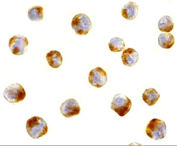 Immunocytochemical staining of MCF7 cells using ATF6 antibody at 10 μg/mL