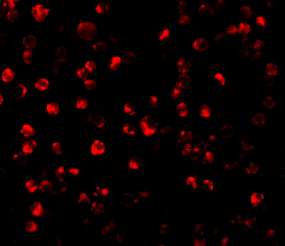 Immunofluorescence of ATF6 in MCF7 cells with ATF6 antibody at 10 μg/mL