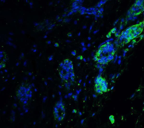 a00655 1 atf6 primary antibodies if testing 5