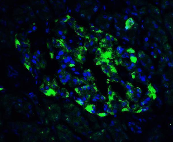 a00655 1 atf6 primary antibodies if testing 7