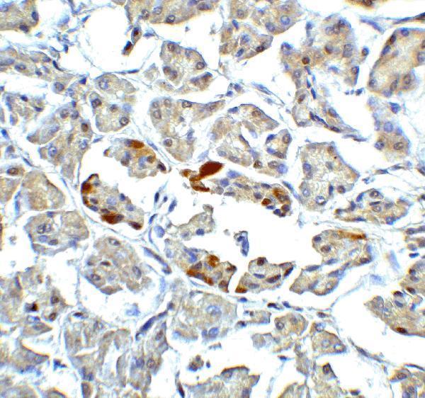 a00655 1 atf6 primary antibodies ihc testing 6