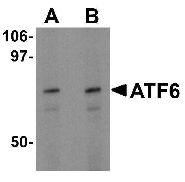 Western blot analysis of ATF6 in EL4 cell lysate with ATF6 antibody at (A) 0