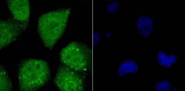 ICC staining ATF6 in HUVEC cells (green)