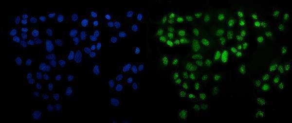  IF analysis of ATF6 using anti-ATF6 antibody (A00655-3)