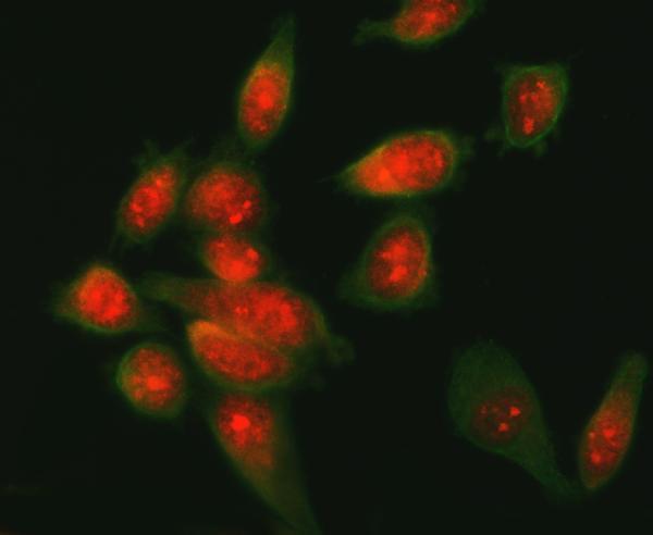 IF analysis of ATF6 using anti-ATF6 antibody (A00655-4) and anti-Beta Tubulin antibody (M01857-3)