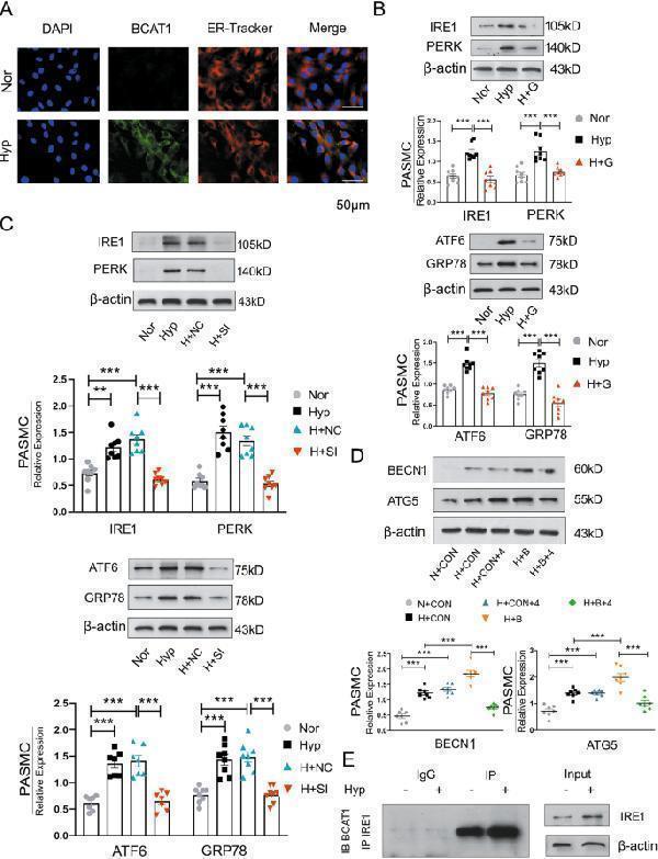 BCAT1 regulates autophagy through the endoplasmic reticulum stress pathway