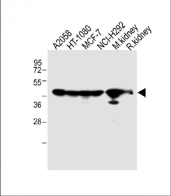All lanes : Anti-MMP14 Antibody (N-term) at 1:2000 dilutionLane 1: A2058 whole cell lysateLane 2: HT-1080 whole cell lysateLane 3: MCF-7 whole cell lysateLane 4: NCI-H292 whole cell lysateLane 5: Mouse kidney lysateLane 5: Rat kidney lysateLysates/proteins at 20 µg per lane