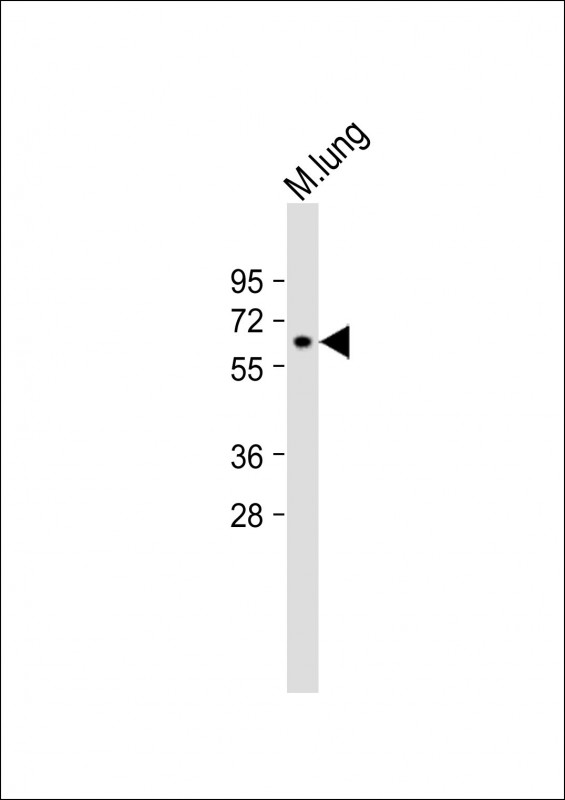 Anti-MMP14 Antibody (N-term) at 1:2000 dilution + Mouse lung lysateLysates/proteins at 20 µg per lane