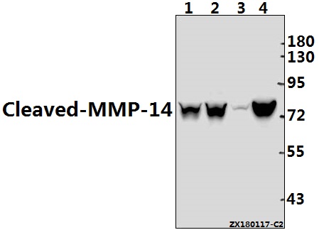 Western blot (WB) analysis of Cleaved-MMP-14 (Y112) pAb at 1:500 dilution
Lane1:HCT116 whole cell lysate(40ug)
Lane2:MCF-7 whole cell lysate(40ug)
Lane3:The Uterus tissue lysate of Rat(40ug)
Lane4:The Testis tissue lysate of Mouse(40ug)