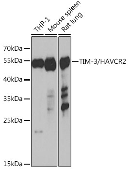Western blot analysis of extracts of various cell lines, using TIM-3/HAVCR2 antibody  at 1:1000 dilution