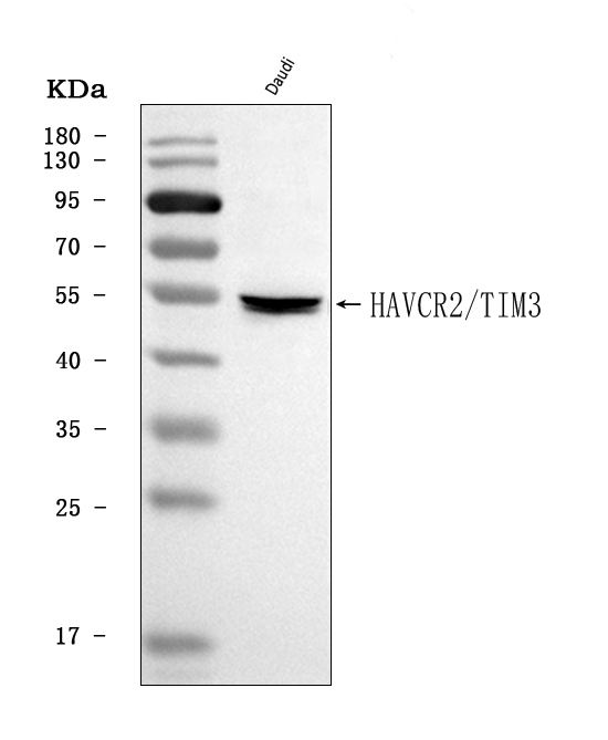  Western blot analysis of TIM 3/HAVCR2 using anti-TIM 3/HAVCR2 antibody (A00657-4)