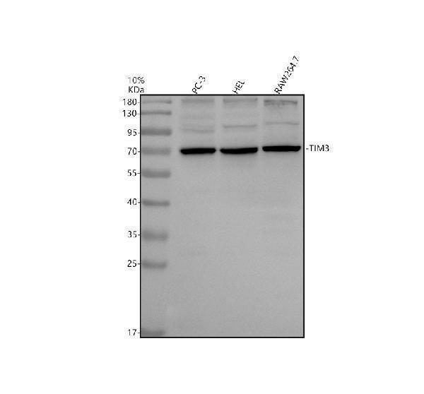 Western blot analysis of TIM3/HAVCR2 using anti-TIM3/HAVCR2 antibody (A00657-5)