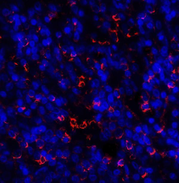 Immunofluorescence of TIM-3 in human spleen tissue with TIM-3 antibody at 20 μg/ml