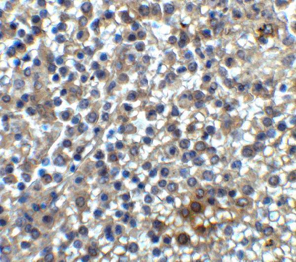 Immunohistochemistry of TIM-3 in human spleen tissue with TIM-3 antibody at 2 μg/ml