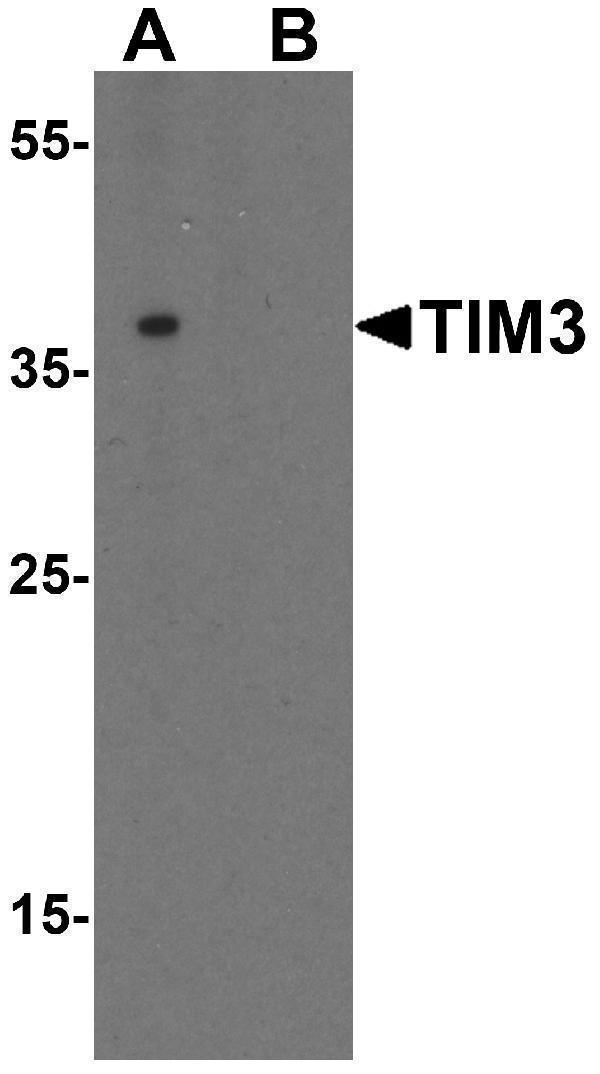 Western blot analysis of TIM-3 in Jurkat cell lysate with TIM-3 antibody at 1 μg/mL in (A) the absence and (B) the presence of blocking peptide