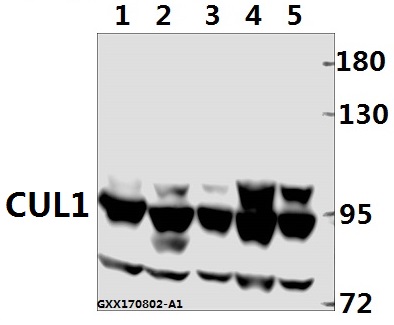 Western blot (WB) analysis of CUL1 (Y761) pAb at 1:500 dilution
Lane1:The Brain tissue lysate of Rat(40ug)
Lane2:The Lung tissue lysate of Rat(40ug)
Lane3:The Lung tissue lysate of Mouse(40ug)
Lane4:A549 whole cell lysate(40ug)
Lane5:HCC827 whole cell lysate(40ug)