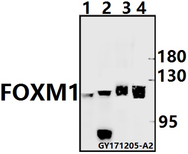 Western blot (WB) analysis of FOXM1 pAb at 1:500 dilution
Lane1:The Testis tissue lysate of Mouse(40ug)
Lane2:The Uterus tissue lysate of Rat(40ug)
Lane3:H1792 whole cell lysate(20ug)
Lane4:MCF-7 whole cell lysate(40ug)