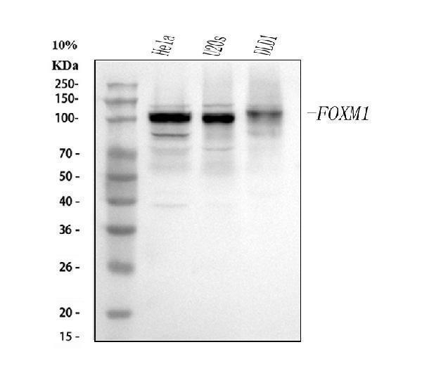  Western blot analysis of FOXM1 using anti-FOXM1 antibody (A00659-2)