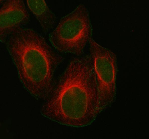 IF analysis of FOXM1 using anti-FOXM1 antibody (A00659-3) and anti-Beta Tubulin antibody (M01857-3)