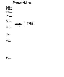 a00662 1 tfeb primary antibodyes wb testing 2