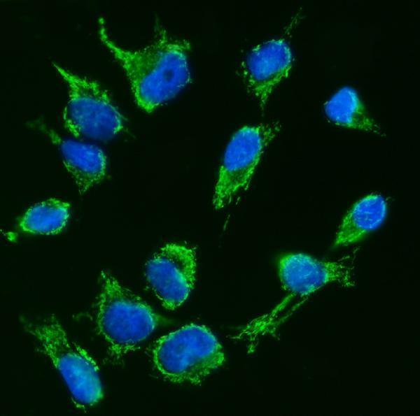 a00662 4 tfeb primary antibodies if testing 10
