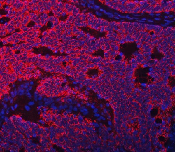 a00662 4 tfeb primary antibodies if testing 12