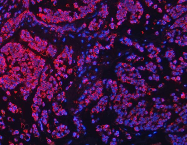 a00662 4 tfeb primary antibodies if testing 13