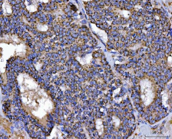  IHC analysis of TFEB using anti-TFEB antibody (A00662-4)