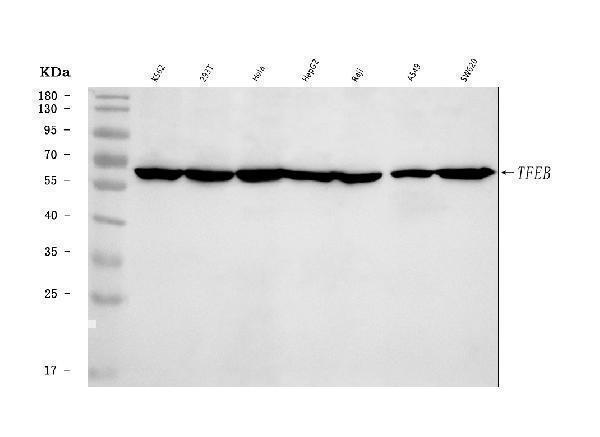  Western blot analysis of TFEB using anti-TFEB antibody (A00662-4)