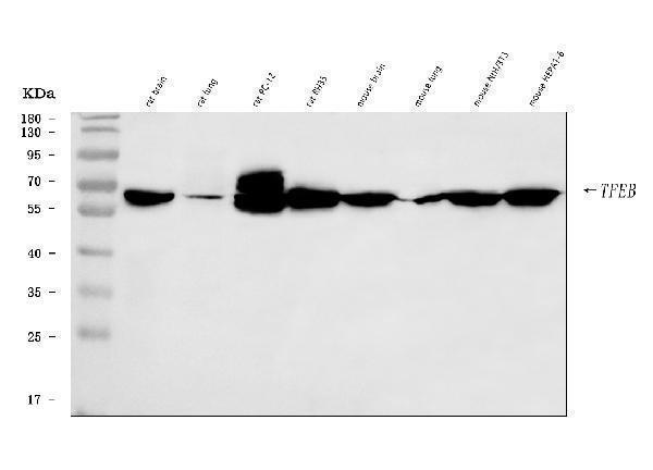  Western blot analysis of TFEB using anti-TFEB antibody (A00662-4)