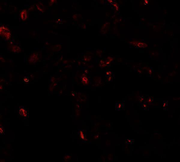 Immunofluorescence of TFEB in human lung tissue with TFEB antibody at 20 μg/mL