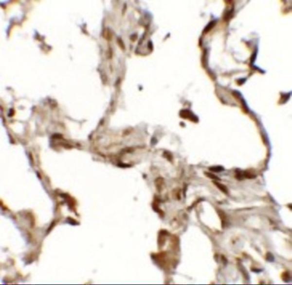 Immunohistochemistry of TFEB (NT) in human lung tissue with TFEB (NT) antibody at 2