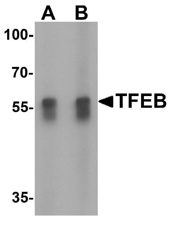 Western blot analysis of TFEB in A549 cell lysate with TFEB antibody at (A) 1 and (B) 2 μg/mL