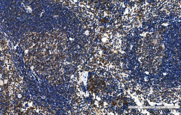  IHC analysis of TFEB using anti-TFEB antibody (A00663-1)