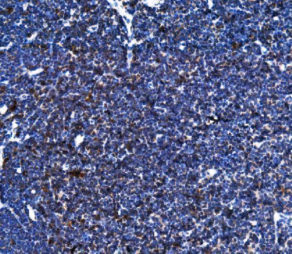 IHC analysis of TFEB using anti-TFEB antibody (A00663-1)