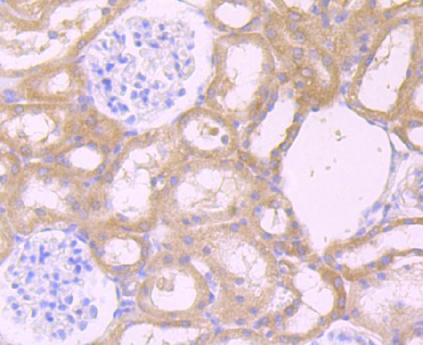 Immunohistochemical analysis of paraffin-embedded rat kidney tissue using anti-CXCR5 antibody