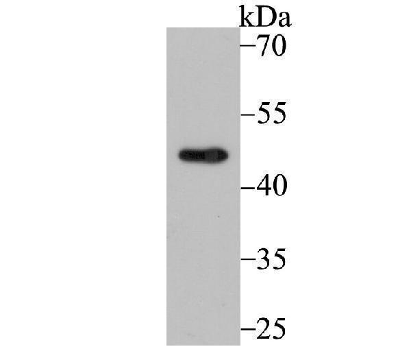 Western blot analysis of CXCR5 on Daudi cell using anti-CXCR5 antibody at 1/500 dilution