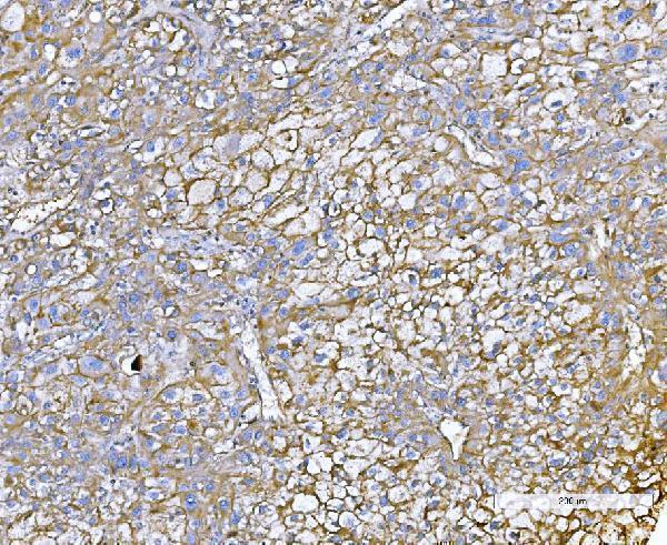  IHC analysis of Poliovirus Receptor/PVR using anti-Poliovirus Receptor/PVR antibody (A00664-4)
